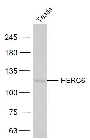 Fig2: Sample:; Testis (Mouse) Lysate at 40 ug; Primary: Anti-HERC6 at 1/300 dilution; Secondary: IRDye800CW Goat Anti-Rabbit IgG at 1/20000 dilution; Predicted band size: 115 kD; Observed band size: 115 kD