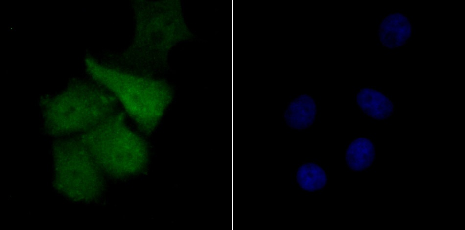 Fig4: ICC staining Tle6 in SK-Br-3 cells (green). The nuclear counter stain is DAPI (blue). Cells were fixed in paraformaldehyde, permeabilised with 0.25% Triton X100/PBS.
