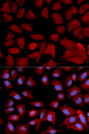 Immunofluorescence - PSMC4 Polyclonal Antibody 