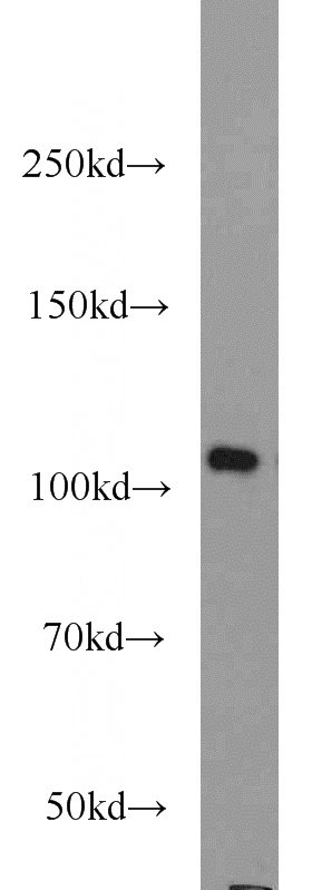 HEK-293 cells were subjected to SDS PAGE followed by western blot with Catalog No:113243(NLRX1 antibody) at dilution of 1:1000