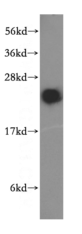 mouse brain tissue were subjected to SDS PAGE followed by western blot with Catalog No:114418(RAB2A antibody) at dilution of 1:1000