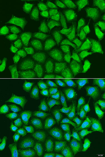 Immunofluorescence - TRAF3 Polyclonal Antibody 