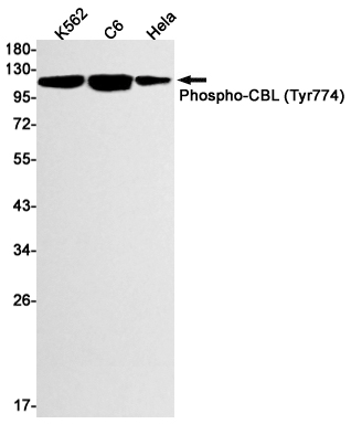 Western blot detection of Phospho-CBL (Tyr774) in K562,C6,Hela cell lysates using Phospho-CBL (Tyr774) Rabbit mAb(1:1000 diluted).Predicted band size:100kDa.Observed band size:120kDa.