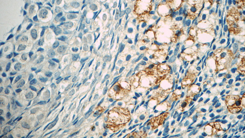Immunohistochemistry of paraffin-embedded human ovary tissue slide using Catalog No:116075(TLR5 Antibody) at dilution of 1:50 (under 40x lens)