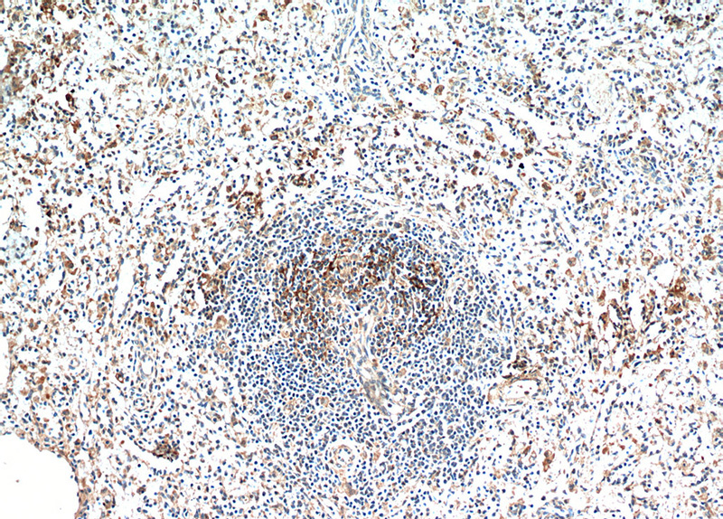 Immunohistochemical of paraffin-embedded human spleen using Catalog No:111883(AMICA1 antibody) at dilution of 1:100 (under 10x lens)