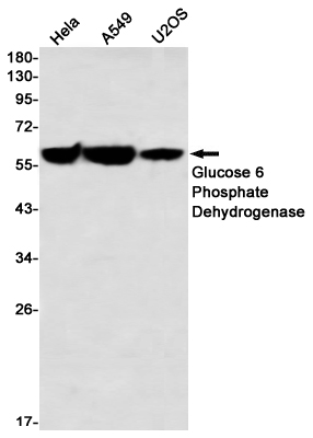 Western blot detection of Glucose 6 Phosphate Dehydrogenase in Hela,A549,U2OS using Glucose 6 Phosphate Dehydrogenase Rabbit mAb(1:1000 diluted)