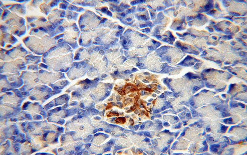 Immunohistochemical of paraffin-embedded human pancreas using Catalog No:109163(CDK5RAP1 antibody) at dilution of 1:100 (under 40x lens)