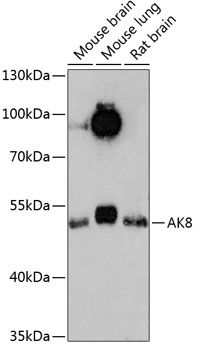 Western blot - AK8 Polyclonal Antibody 