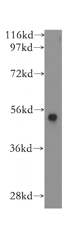BxPC-3 cells were subjected to SDS PAGE followed by western blot with Catalog No:113482(PADI2 antibody) at dilution of 1:300