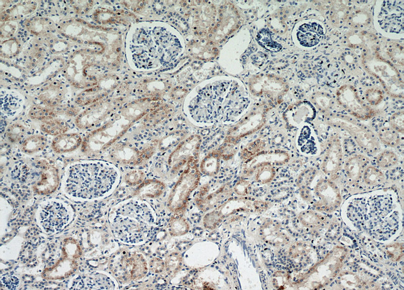 Immunohistochemical of paraffin-embedded human kidney using Catalog No:112731(MOGAT2 antibody) at dilution of 1:50 (under 10x lens)