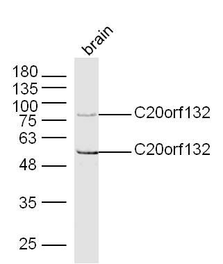 Fig3: Sample: Brain (Mouse) Lysate at 40 ug; Primary: Anti-C20orf132 at 1/300 dilution; Secondary: IRDye800CW Goat Anti-Rabbit IgG at 1/20000 dilution; Predicted band size: 55/99 kD; Observed band size: 55/95 kD