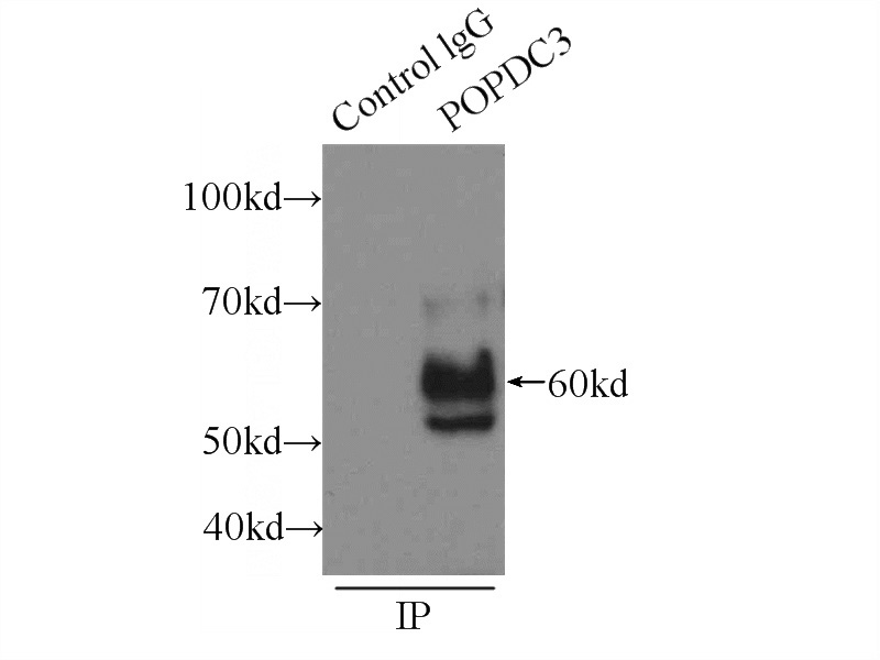 IP Result of anti-POPDC3 (IP:Catalog No:114063, 3ug; Detection:Catalog No:114063 1:1000) with HeLa cells lysate 220ug.
