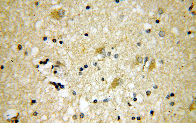 Immunohistochemical of paraffin-embedded human brain using Catalog No:114255(PSTPIP1 antibody) at dilution of 1:50 (under 40x lens)