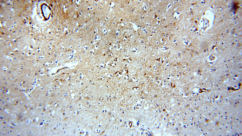 Immunohistochemical of paraffin-embedded human brain using Catalog No:108243(ARF1 antibody) at dilution of 1:100 (under 10x lens)
