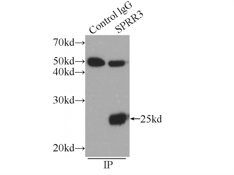 IP Result of anti-SPRR3 (IP:Catalog No:115647, 3ug; Detection:Catalog No:115647 1:500) with COLO 320 cells lysate 1720ug.