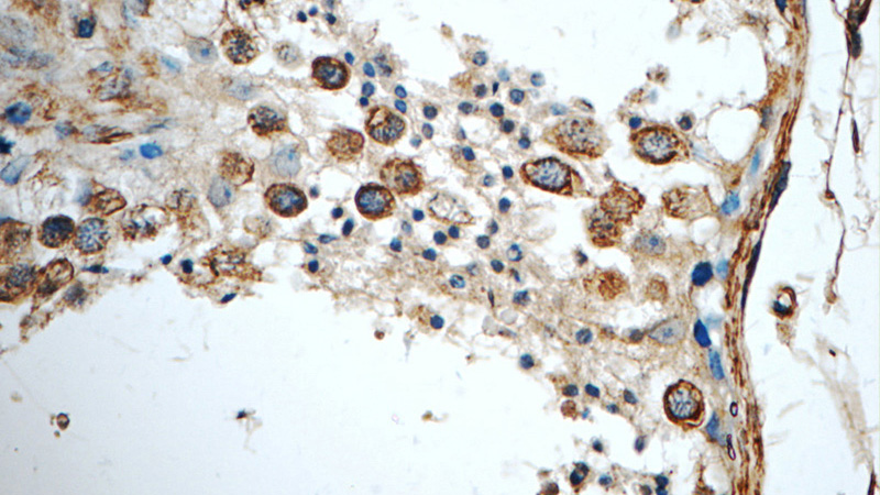 Immunohistochemistry of paraffin-embedded human testis tissue slide using Catalog No:112049(KIF5C Antibody) at dilution of 1:50 (under 40x lens)