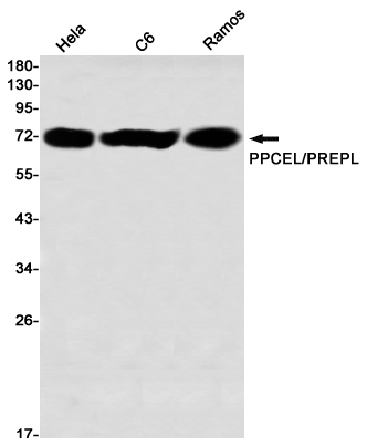 Western blot detection of PPCEL/PREPL in Hela,C6,Ramos using PPCEL/PREPL Rabbit mAb(1:1000 diluted)