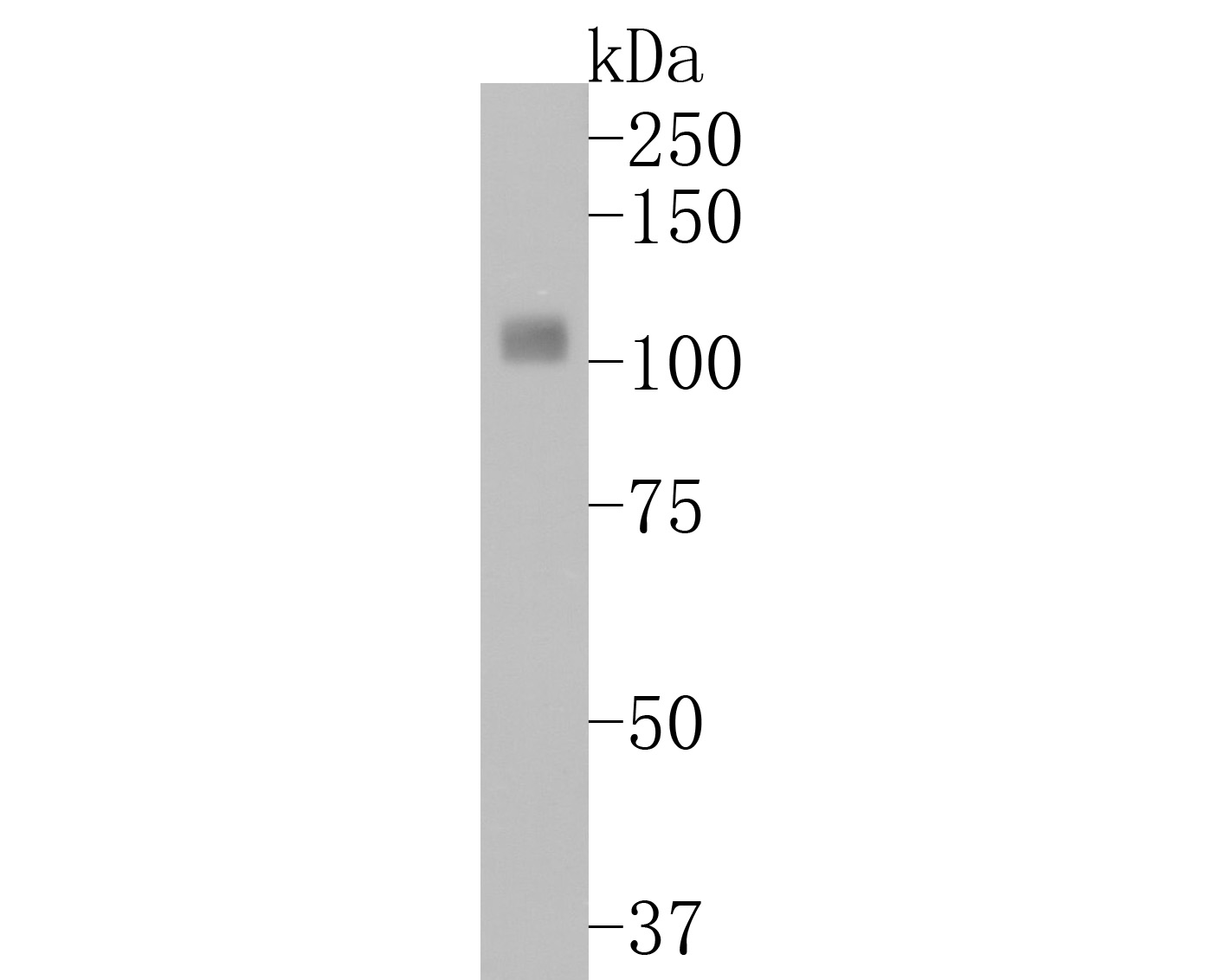 Fig3:; Western blot analysis of TrkA on rat brain tissue lysates. Proteins were transferred to a PVDF membrane and blocked with 5% BSA in PBS for 1 hour at room temperature. The primary antibody ( 1/500) was used in 5% BSA at room temperature for 2 hours. Goat Anti-Rabbit IgG - HRP Secondary Antibody (HA1001) at 1:200,000 dilution was used for 1 hour at room temperature.