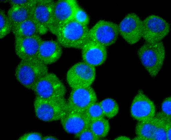 Fig5:; ICC staining of TrkA in N2A cells (green). Formalin fixed cells were permeabilized with 0.1% Triton X-100 in TBS for 10 minutes at room temperature and blocked with 10% negative goat serum for 15 minutes at room temperature. Cells were probed with the primary antibody ( 1/50) for 1 hour at room temperature, washed with PBS. Alexa Fluor®488 conjugate-Goat anti-Rabbit IgG was used as the secondary antibody at 1/1,000 dilution. The nuclear counter stain is DAPI (blue).