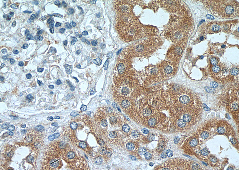 Immunohistochemistry of paraffin-embedded human kidney tissue slide using Catalog No:108653(C13orf30 Antibody) at dilution of 1:200 (under 40x lens).