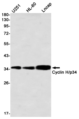 Western blot detection of Cyclin H/p34 in U251,HL-60,Lncap using Cyclin H/p34 Rabbit mAb(1:1000 diluted)