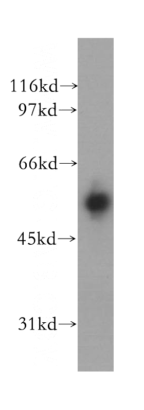 human heart tissue were subjected to SDS PAGE followed by western blot with Catalog No:111786(IMPDH2 antibody) at dilution of 1:400