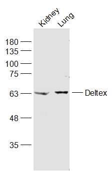 Fig1: Sample:; Kidney (Mouse) Lysate at 40 ug; Lung (Mouse) Lysate at 40 ug; Primary: Anti-Deltex at 1/1000 dilution; Secondary: IRDye800CW Goat Anti-Rabbit IgG at 1/20000 dilution; Predicted band size: 67 kD; Observed band size: 67 kD