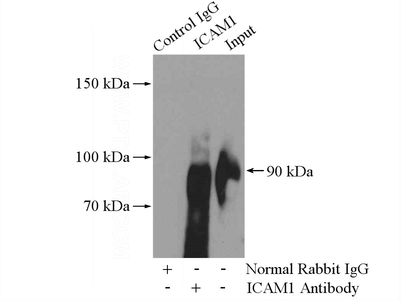 IP Result of anti-ICAM-1 (IP:Catalog No:111589, 4ug; Detection:Catalog No:111589 1:500) with Raji cells lysate 1520ug.