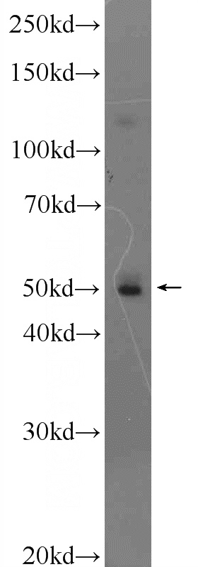 HeLa cells were subjected to SDS PAGE followed by western blot with Catalog No:114101(PPP2R2C Antibody) at dilution of 1:1000