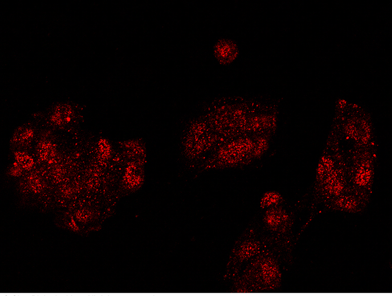 Human SMURF2 Immunofluorescence(IF) 15147