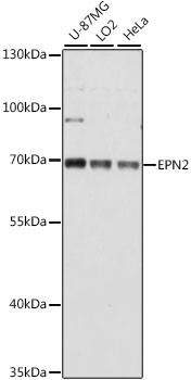 Western blot - EPN2 Polyclonal Antibody 