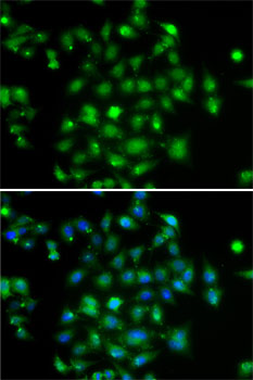Immunofluorescence - DYRK2 Polyclonal Antibody 