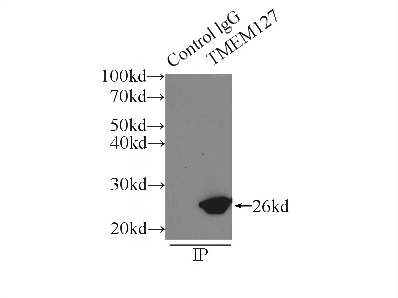 IP Result of anti-TMEM127 (IP:Catalog No:116096, 3ug; Detection:Catalog No:116096 1:500) with HeLa cells lysate 3000ug.
