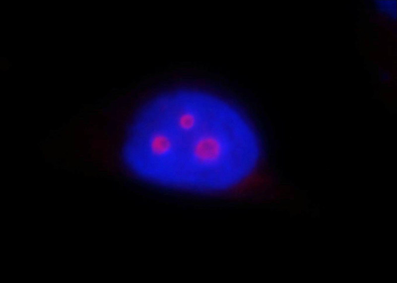 Immunofluorescent analysis of MCF-7 cells, using B23 antibody Catalog No: at 1:25 dilution and Rhodamine-labeled goat anti-mouse IgG (red). Blue pseudocolor = DAPI (fluorescent DNA dye).