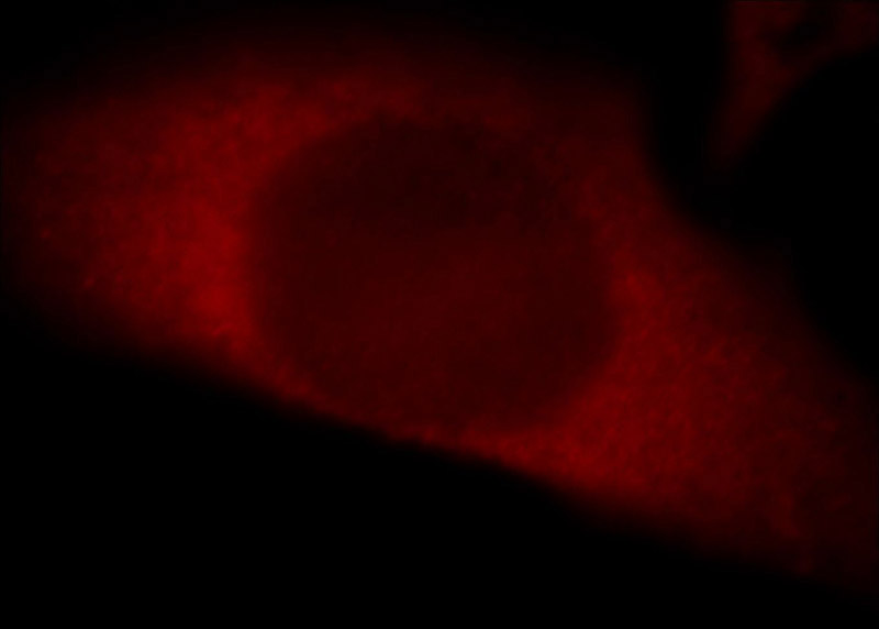 Immunofluorescent analysis of Hela cells, using THUMPD3 antibody Catalog No:116114 at 1:25 dilution and Rhodamine-labeled goat anti-rabbit IgG (red).