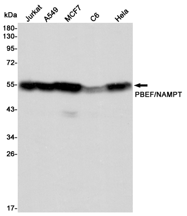 Western blot detection of PBEF/NAMPT in Jurkat,A549,MCF7,C6 and Hela cell lysates using PBEF/NAMPT mouse mAb (1:5000 diluted).Predicted band size:56KDa.Observed band size:52KDa.