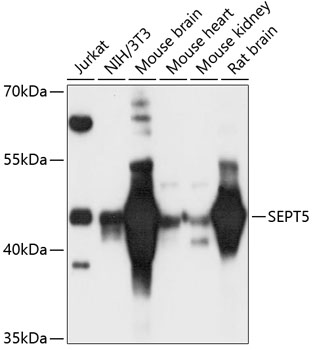 Western blot - SEPT5 Polyclonal Antibody 