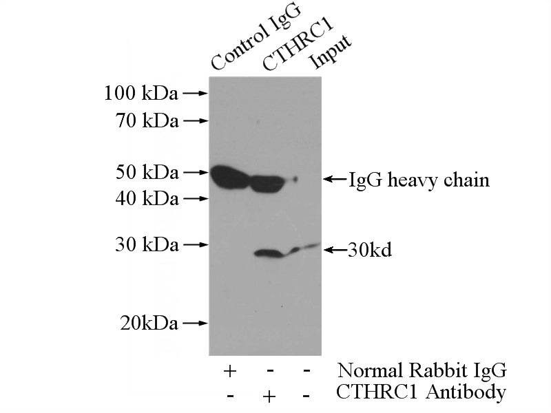 IP Result of anti-CTHRC1 (IP:Catalog No:109724, 3ug; Detection:Catalog No:109724 1:500) with A375 cells lysate 3600ug.