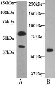 Fig1: Western blot analysis on human kidney (A) and D3 (B) using anti- TMEM57 polyclonal antibody.