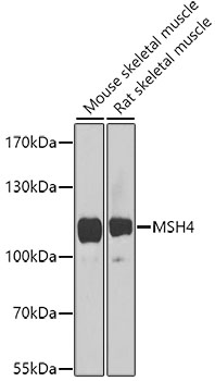 Western blot - MSH4 Polyclonal Antibody 