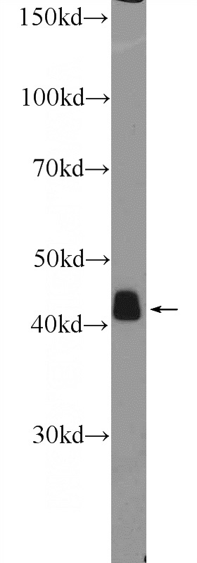 mouse colon tissue were subjected to SDS PAGE followed by western blot with Catalog No:115397(a-SMA specific Antibody) at dilution of 1:600