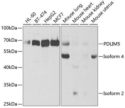 Western blot - PDLIM5 Polyclonal Antibody 