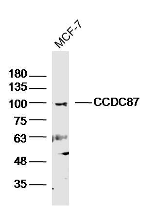Fig1: Sample: MCF-7 (Human)cell Lysate at 40 ug; Primary: Anti-CCDC87 at 1/300 dilution; Secondary: IRDye800CW Goat Anti-RabbitIgG at 1/20000 dilution; Predicted band size: 96kD; Observed band size: 100kD