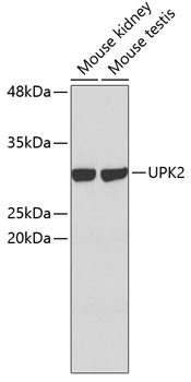 Western blot - UPK2 Polyclonal Antibody 
