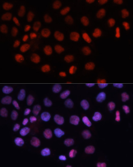 Immunofluorescence - RCC1 Polyclonal Antibody 