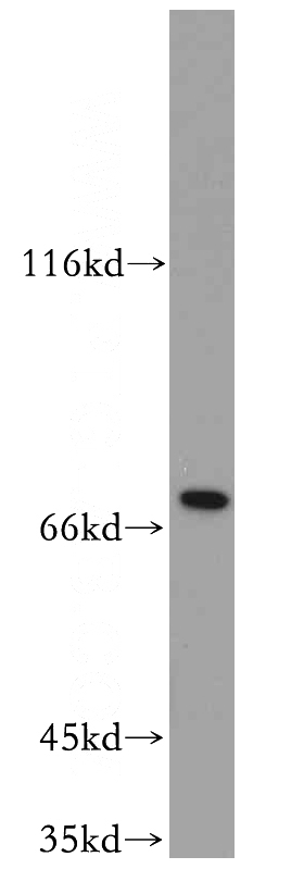 Jurkat cells were subjected to SDS PAGE followed by western blot with Catalog No:115413(SLU7 antibody) at dilution of 1:100