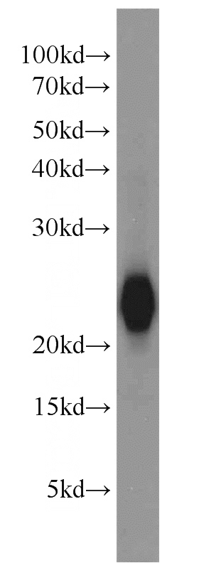 mouse brain tissue were subjected to SDS PAGE followed by western blot with Catalog No:116751(VSNL1 antibody) at dilution of 1:1500