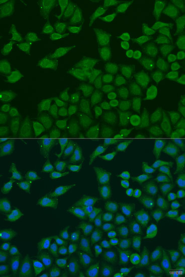 Immunofluorescence - PLA2G4C Polyclonal Antibody 