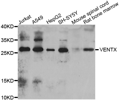 Western blot - VENTX Polyclonal Antibody 