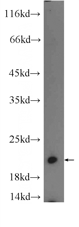 L02 cells were subjected to SDS PAGE followed by western blot with Catalog No:116476(UBC12 Antibody) at dilution of 1:600